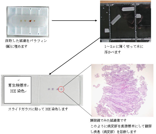 病理組織標本作製図