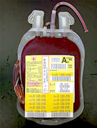 赤血球輸血の写真