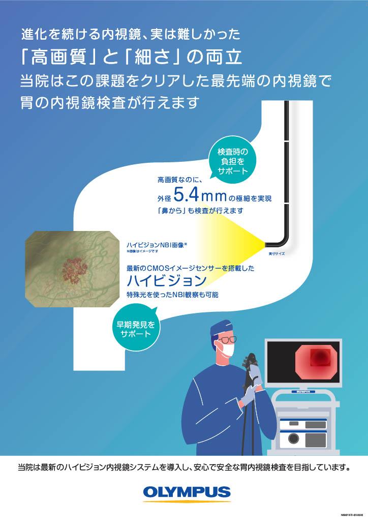 胃内視鏡検査